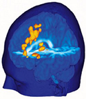 brain pain map